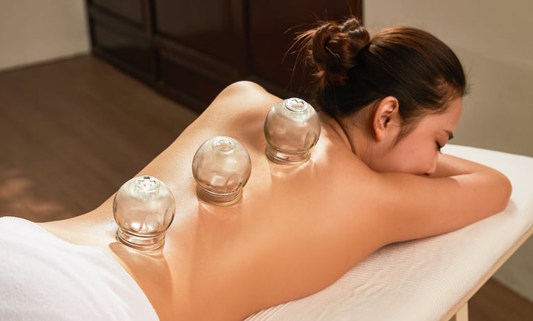Une femme sur une table de soins se fait poser des ventouses, ou de la cupping thérapie