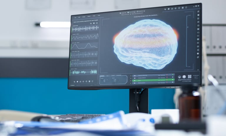 a computer monitor screen displaying a brain scang