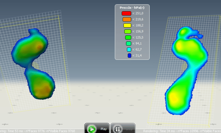 exame de baropodometria para análise da marcha e pisada