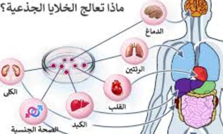التصلب المتعدد والصيام