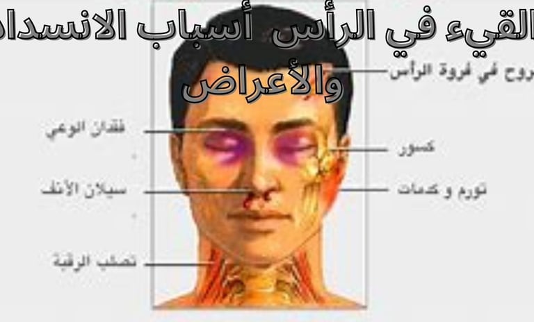 قد يكون أحد أعراض انسداد الدماغ انسداد يمنع التدفق الطبيعي للسائل النخاعي (CSF) في الدماغ يحيط ويح