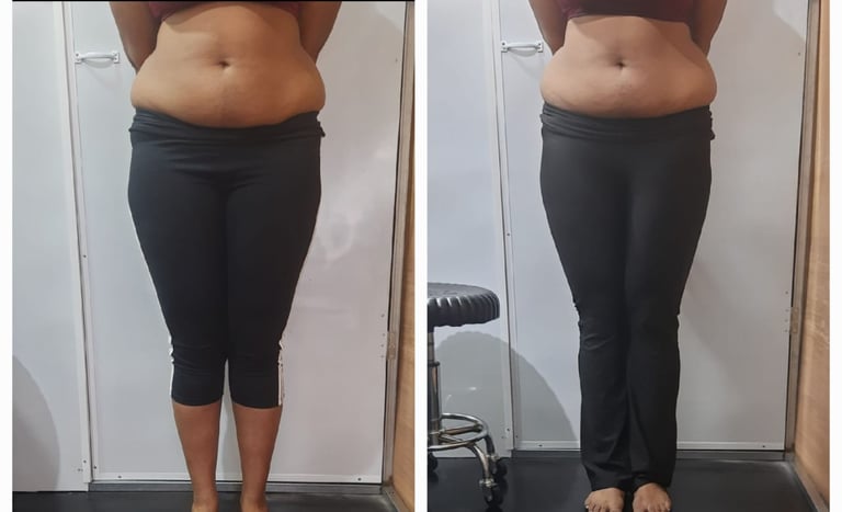 Slimmer waistline before and after fat cavitation body treatment