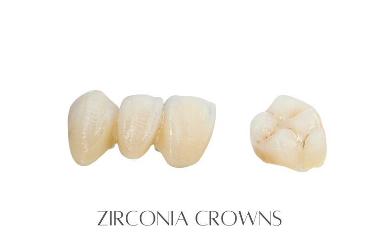 Zirconia Crowns