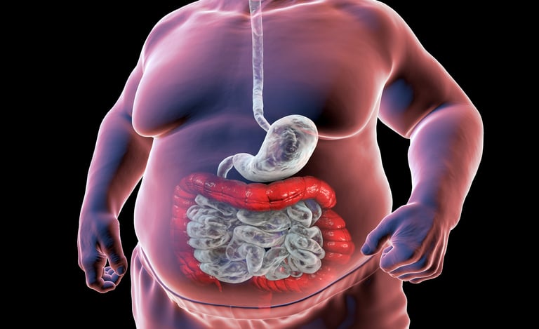 Fecal Microbiota Transplantation (FMT): A Promising Solution for Metabolic Syndrome 
