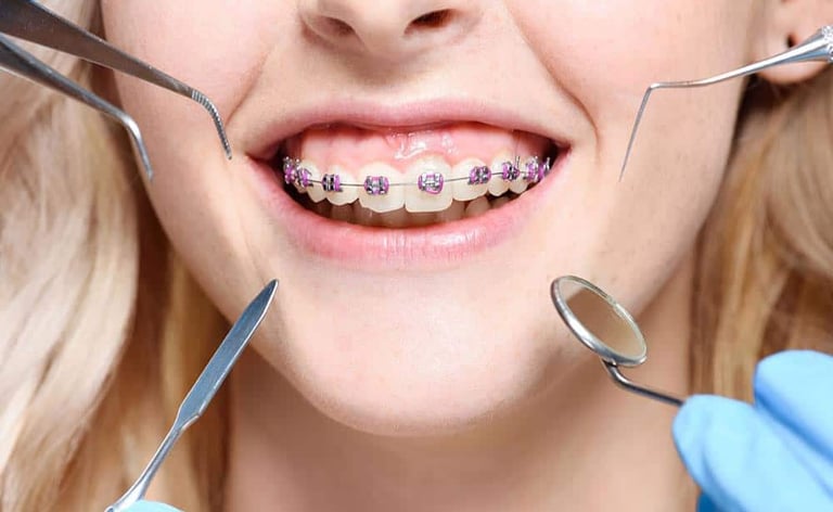 Best Orthodontists in Wadgaon Sheri Pune