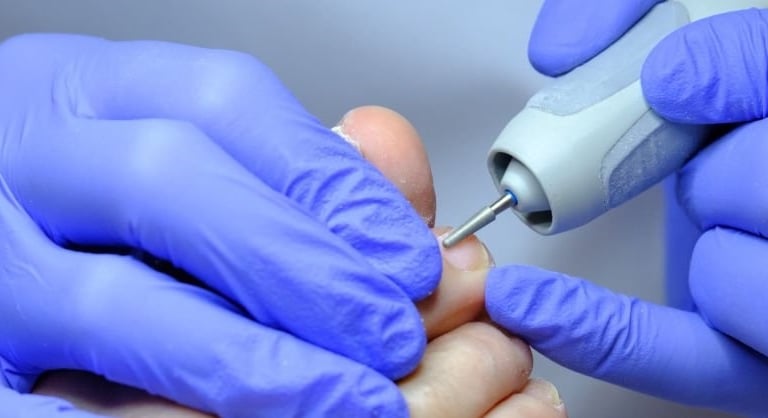 fusspflege in overath Behandlung