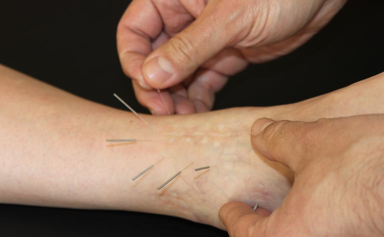 Dr .Robert Inesta Acupuncture