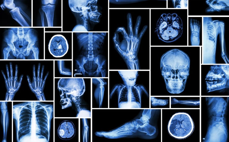Radiologie à domicile