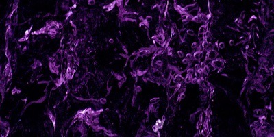 purple black abstract