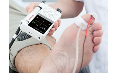 vascular ultrasound photoplethysmography ppg finger toe pressure index digital diabetes blood flow peripheral artery disease