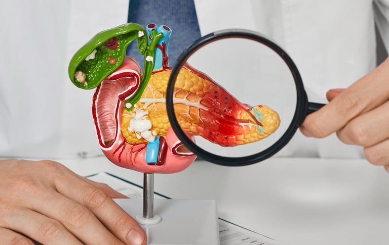 Ca Pancreas