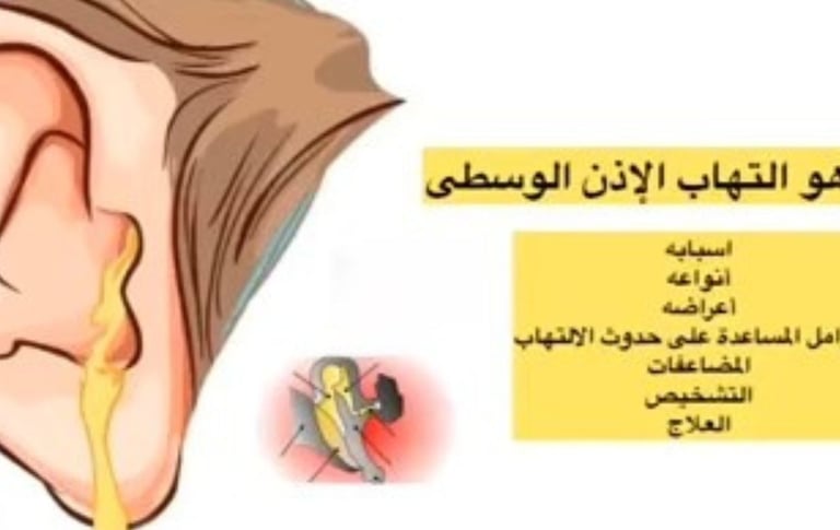 الاذن الوسطى الالتهاب