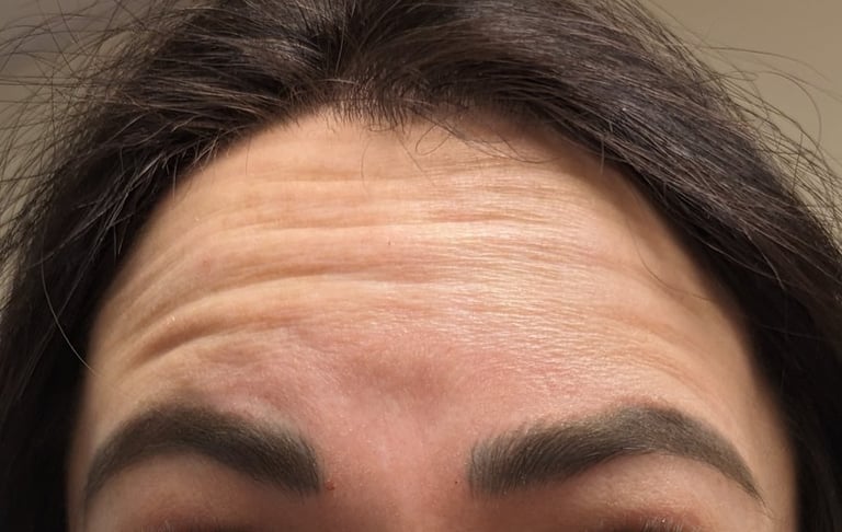 Inspire Salon and Day Spa client before Botox Treatment