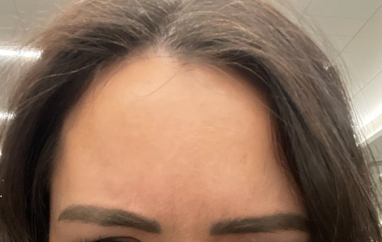 Inspire Salon and Day Spa client after Botox Treatment