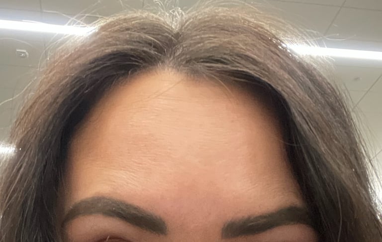 Inspire Salon and Day Spa client after Botox Treatment