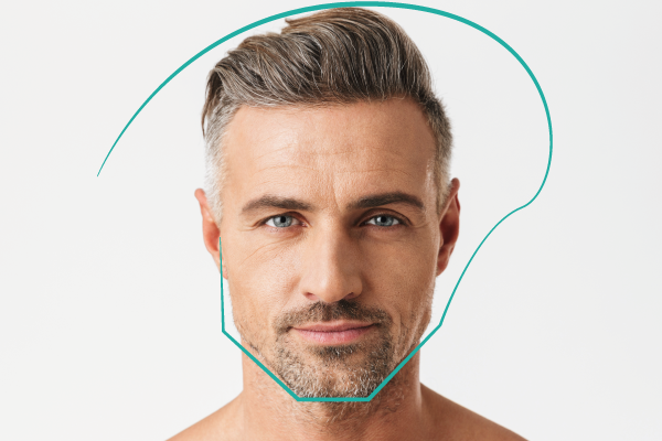 Armonización facial masculina para definir el mentón y resaltar los rasgos del rostro