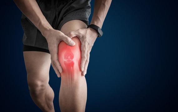 Osteoarthritis I Rheumatoid arthritis I Knee pain 