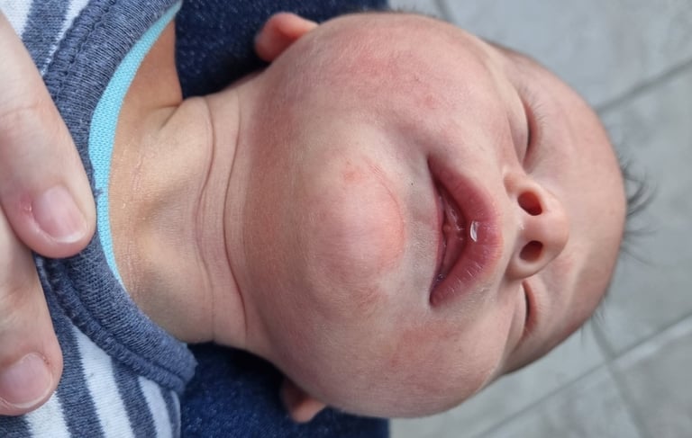 baby having bodywork for breastfeeding difficulties with RM Anika Riesen