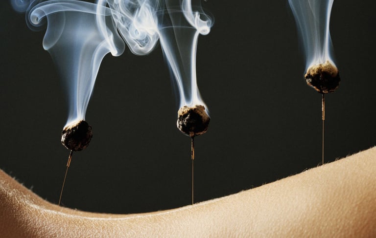Acupuncture Montauban