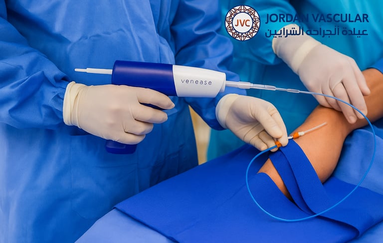 venaseal procedure Amman Jordan