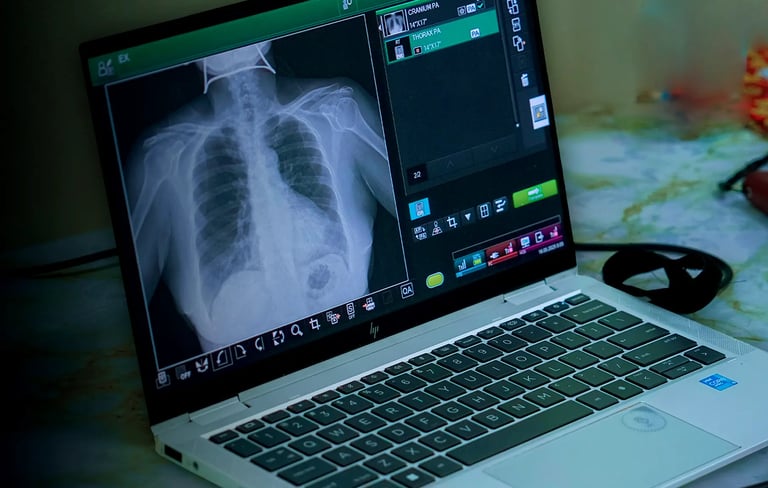 Tampilan hasil rontgen dada pada layar laptop di ruang pemeriksaan medis