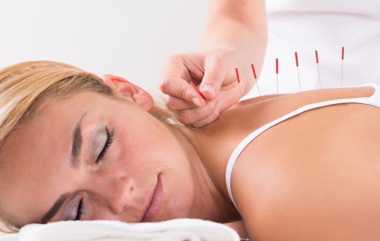Acupuncture treatment