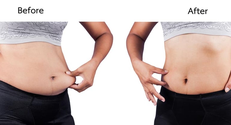 a woman's butt showing before and after her belly lift