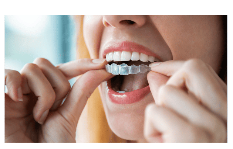 ortodoncia con invisalign en gran canaria