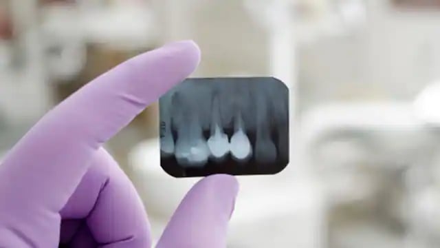 a person holding dental x-ray in hand