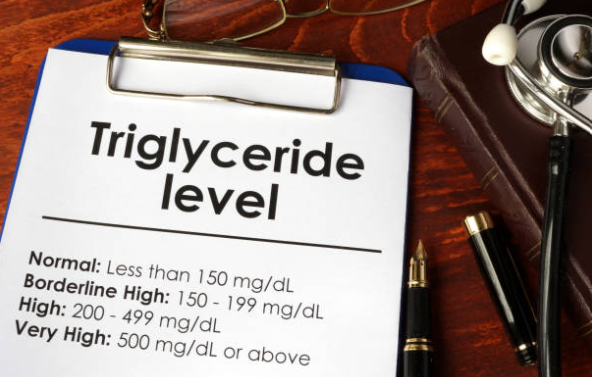 triglycerides levels