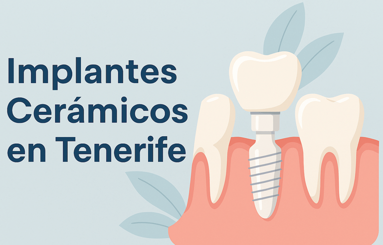 Implantes Cerámicos Tenerife