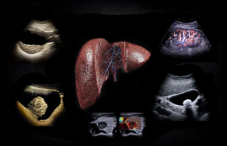 Medical illustration of a human liver surrounded by diagnostic ultrasound and doppler imaging scans.