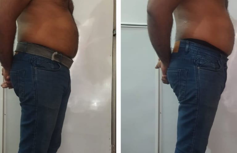Slimmer waistline before and after fat cavitation body treatment
