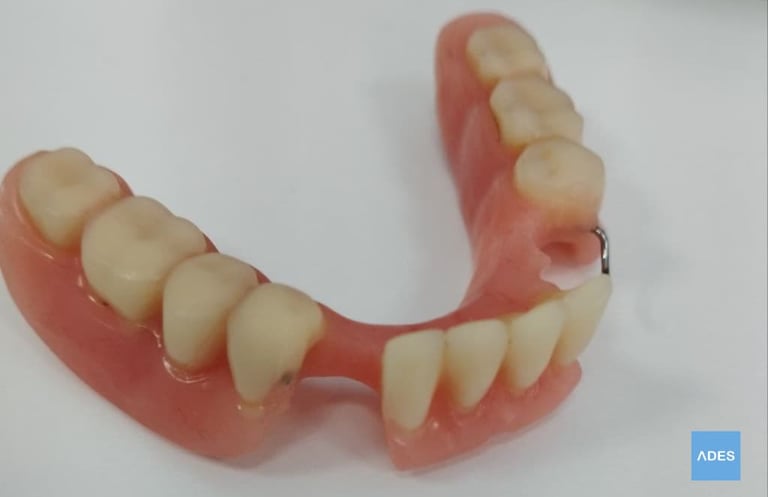 prótesis dental