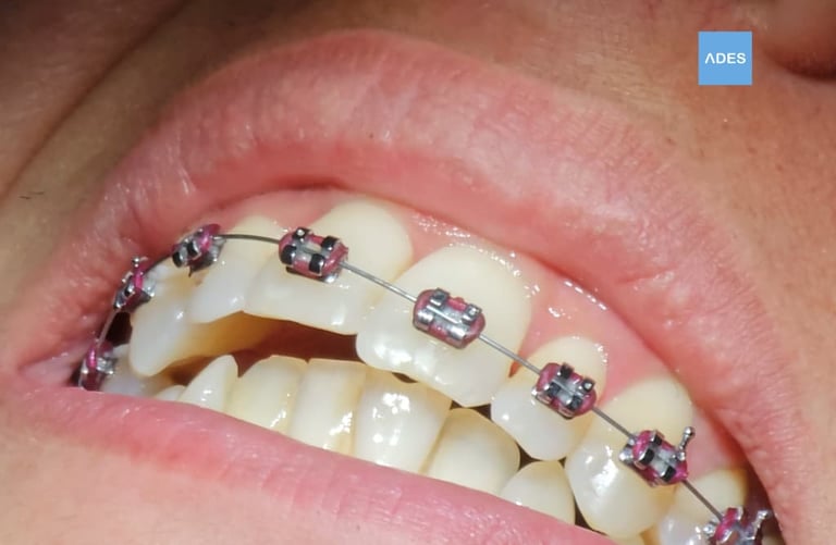 Revisión de ortodoncia en Clínica Dental ADES