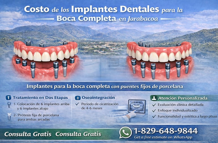 Costo de los implantes dentales para la boca completa en Jarabacoa