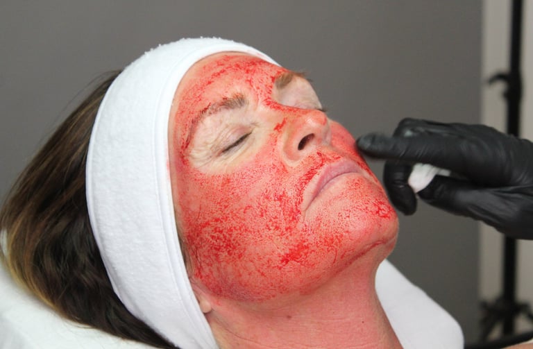 Ansigt under en Vampire Facial vampyr behandling