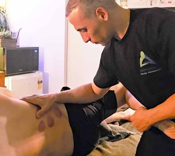 massage with the patient having already had cupping done