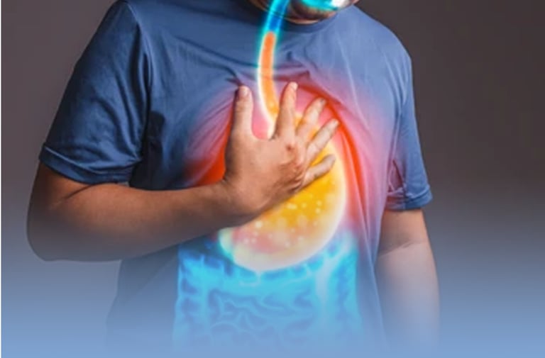 imagem que representa refluxo gastroesofágico