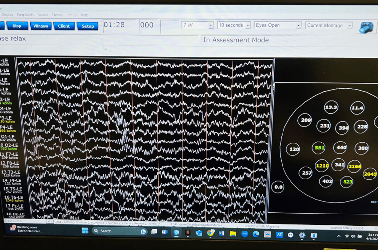 brainwaves
