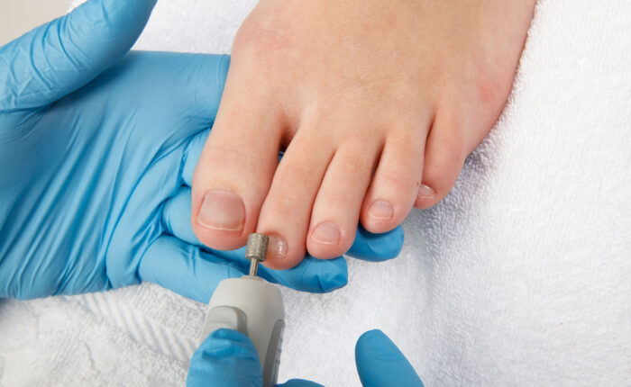 #FußpflegeOverath #Pediküre #GepflegteFüße  #SchöneFüße 