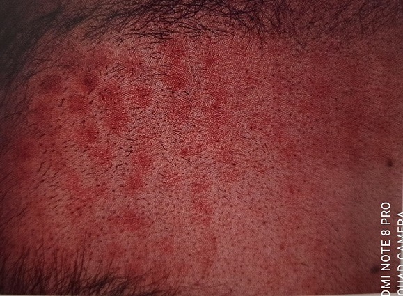 one of non-compliant cases