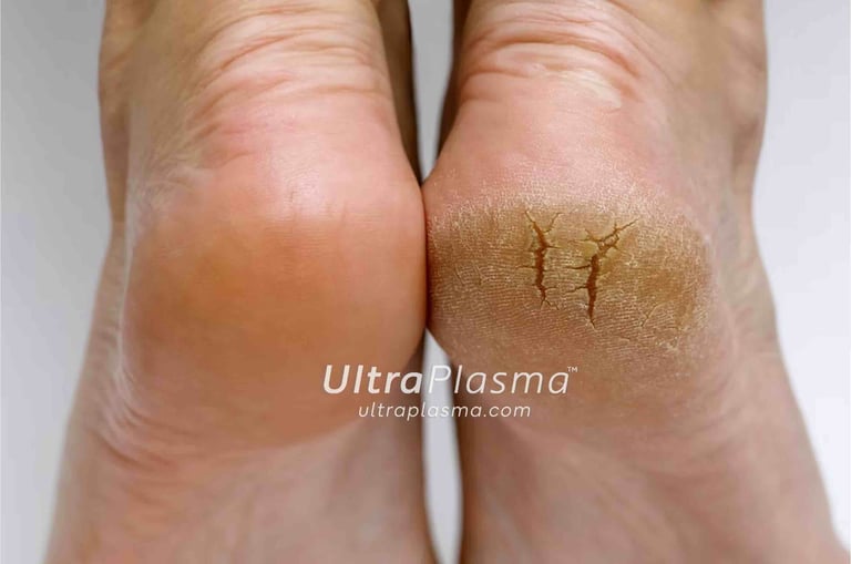 ultra_plasma_ultra_plazma_ultra-plasma_ultra-plazma