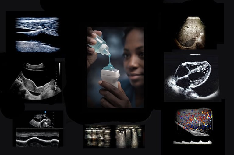 Sonographer applying gel to an ultrasound transducer, surrounded by various ultrasound images.