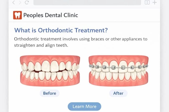 Illustration explaining orthodontic teeth alignment treatment