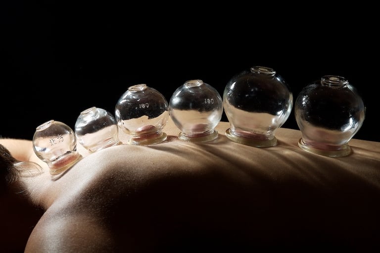 cupping in acupuncture clinic