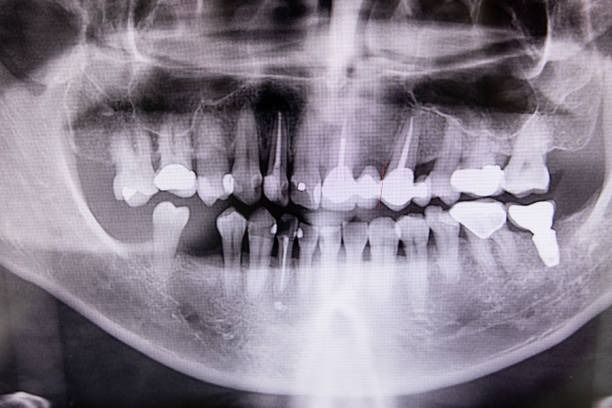 Dental & Vet X-ray Annual Physics Test