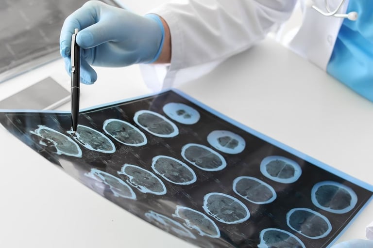 Neurologista em Ribeirão Preto SP