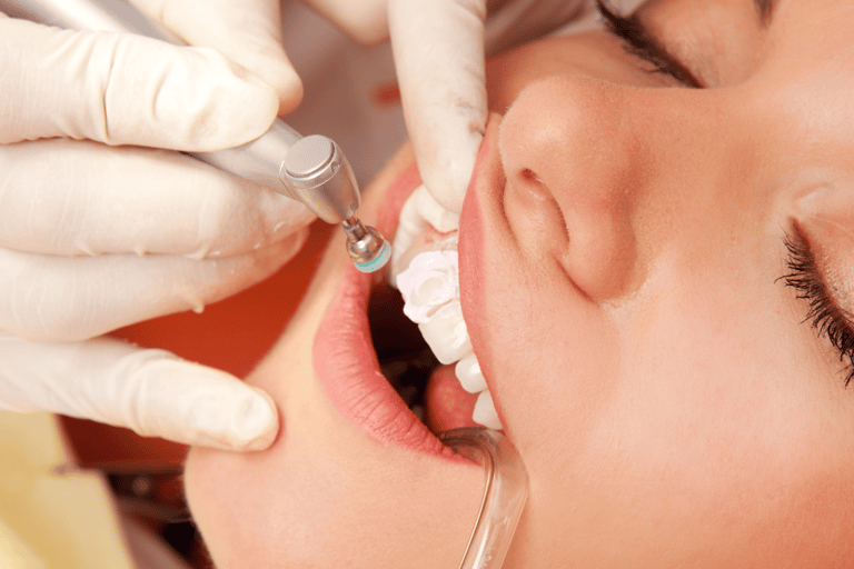 Dental bonding near me | Ekdantam Dental Clinic Navi Mumbai