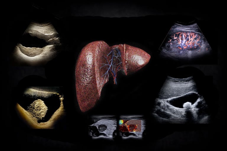 Medical illustration of a human liver surrounded by diagnostic ultrasound and doppler imaging scans.